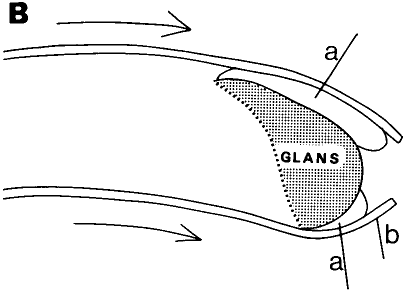 Figure 2b