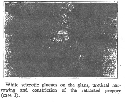 Figure Case 1